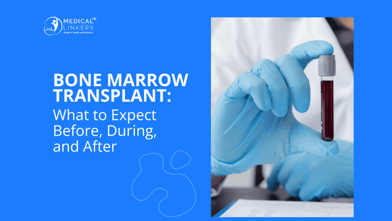 Bone Marrow Transplant: What to Expect Before, During, and After